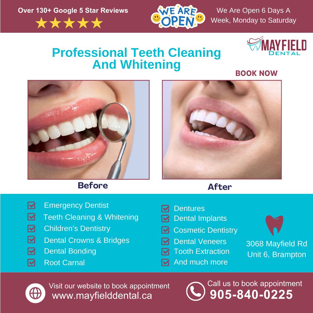 professional teeth cleaning