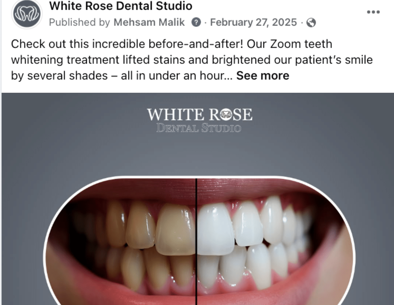 CASE STUDY white rose dental social media 5